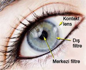 Kontakt Lens Nedir? Nasıl Görüş Sağlar?