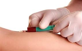HIV Testi Nedir? HIV Testi Erken Tanıda Ne Zaman Yapılır?