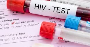 HIV (AIDS) Testi Nedir? HIV Testi Çeşitleri Nelerdir?