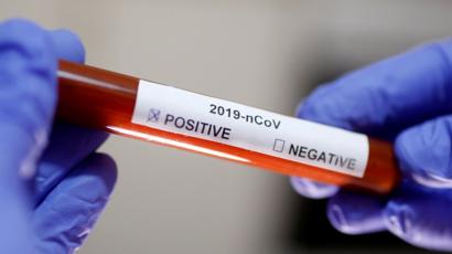 Şüpheli İnsan Vakalarında Corona Virüs Hastalığı (COVID-19) İçin Laboratuvar Testi