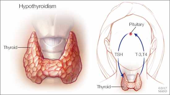 tiroid testleri tsh t3 t4 nasil yorumlanir tahlil yorumlayan saglik sitesi