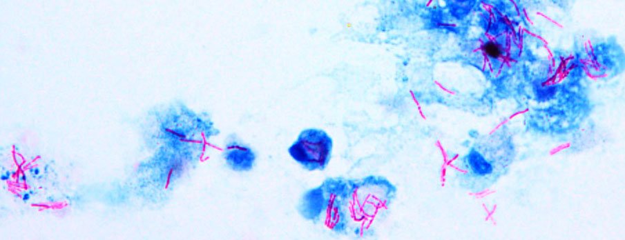 pembe renkli ve ARB boyanmış bakterileri 